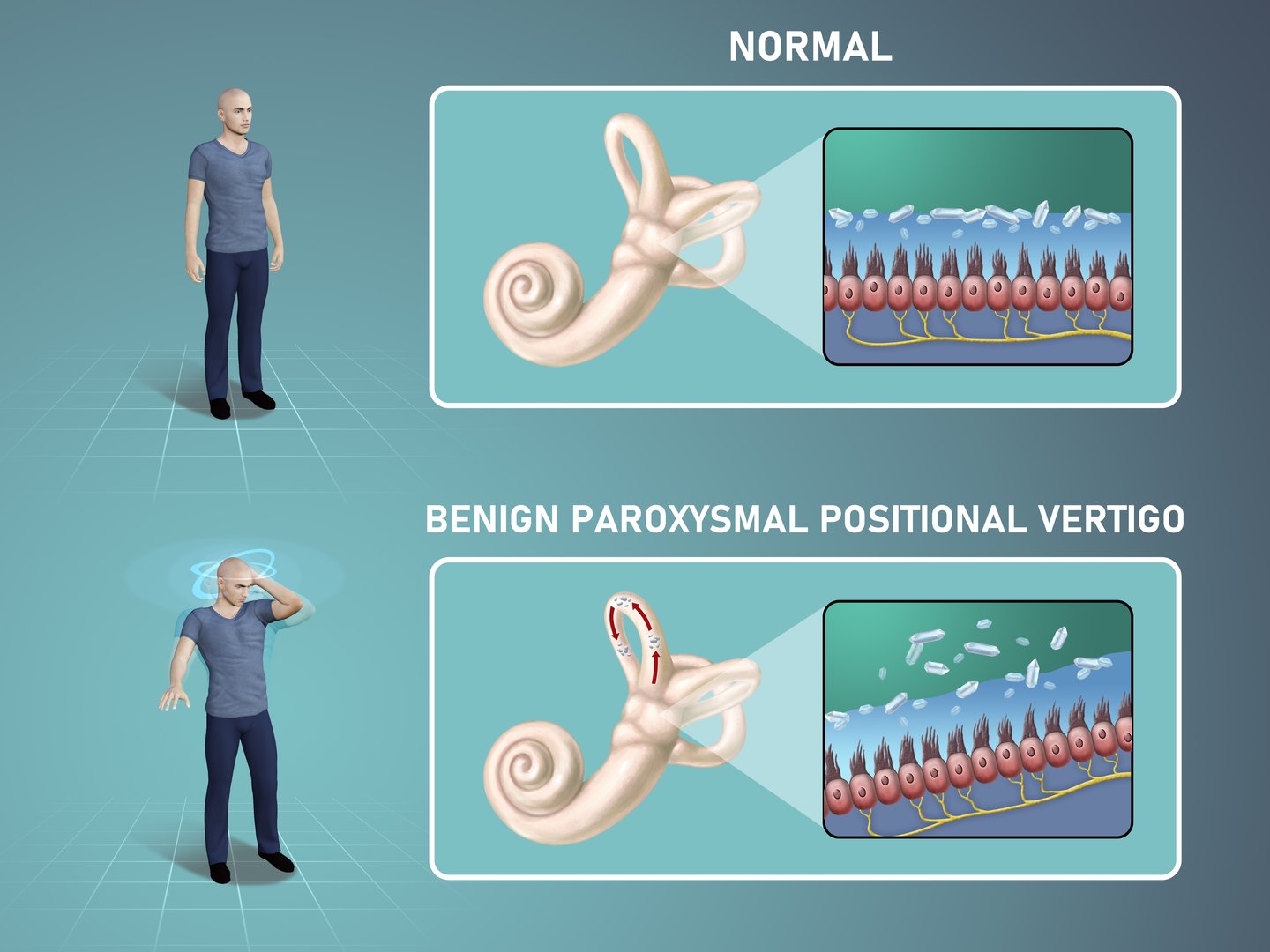 Vertigo dizziness inner ear illustration