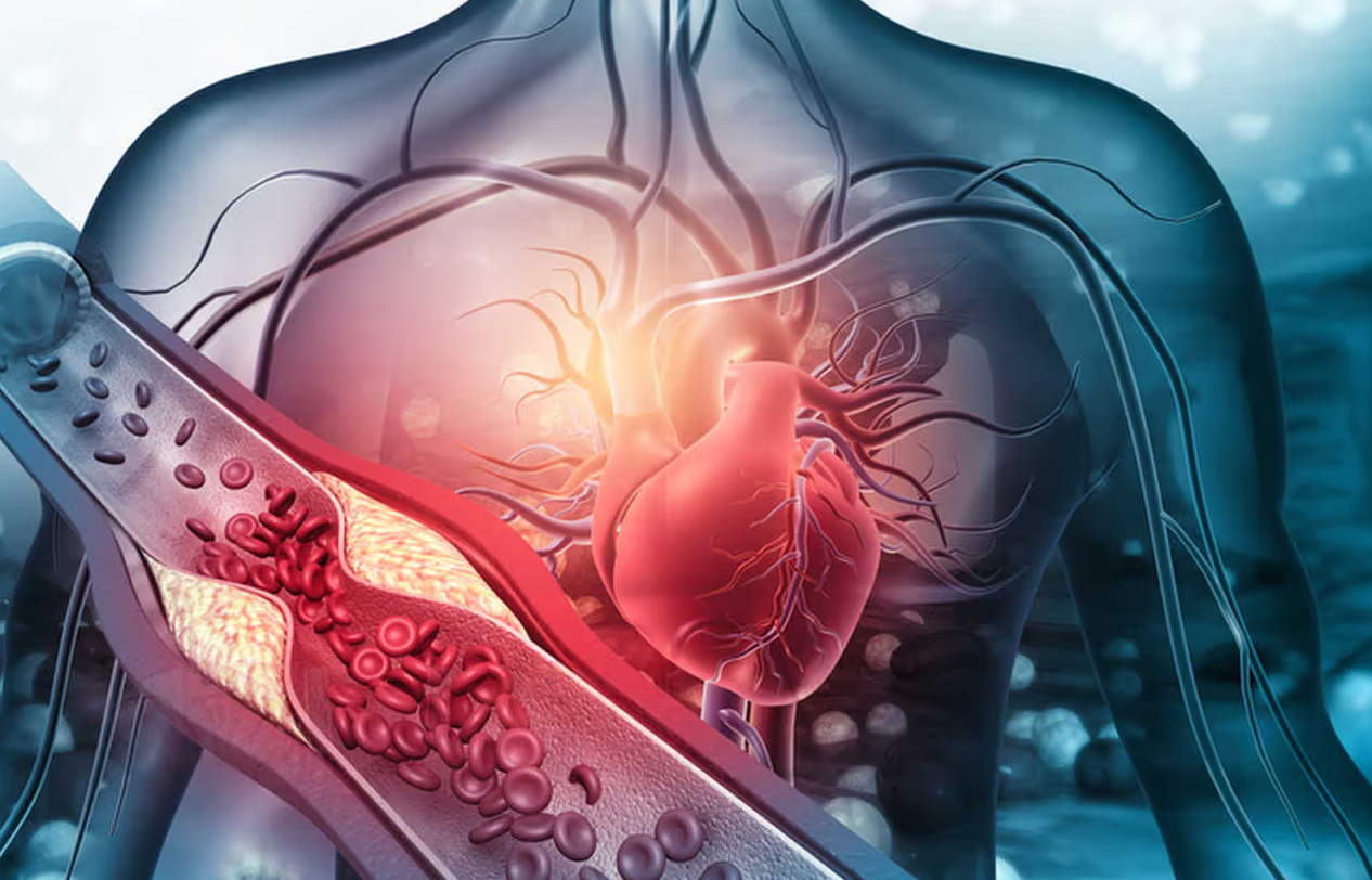 Cateterismo cardíaco procedimiento Dr. Nicholas Flores