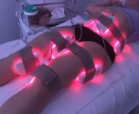 lipo laser. Hardware cosmetology. Body care. Non surgical body sculpting. body contouring treatment, anti-cellulite and anti-fat therapy in beauty salon