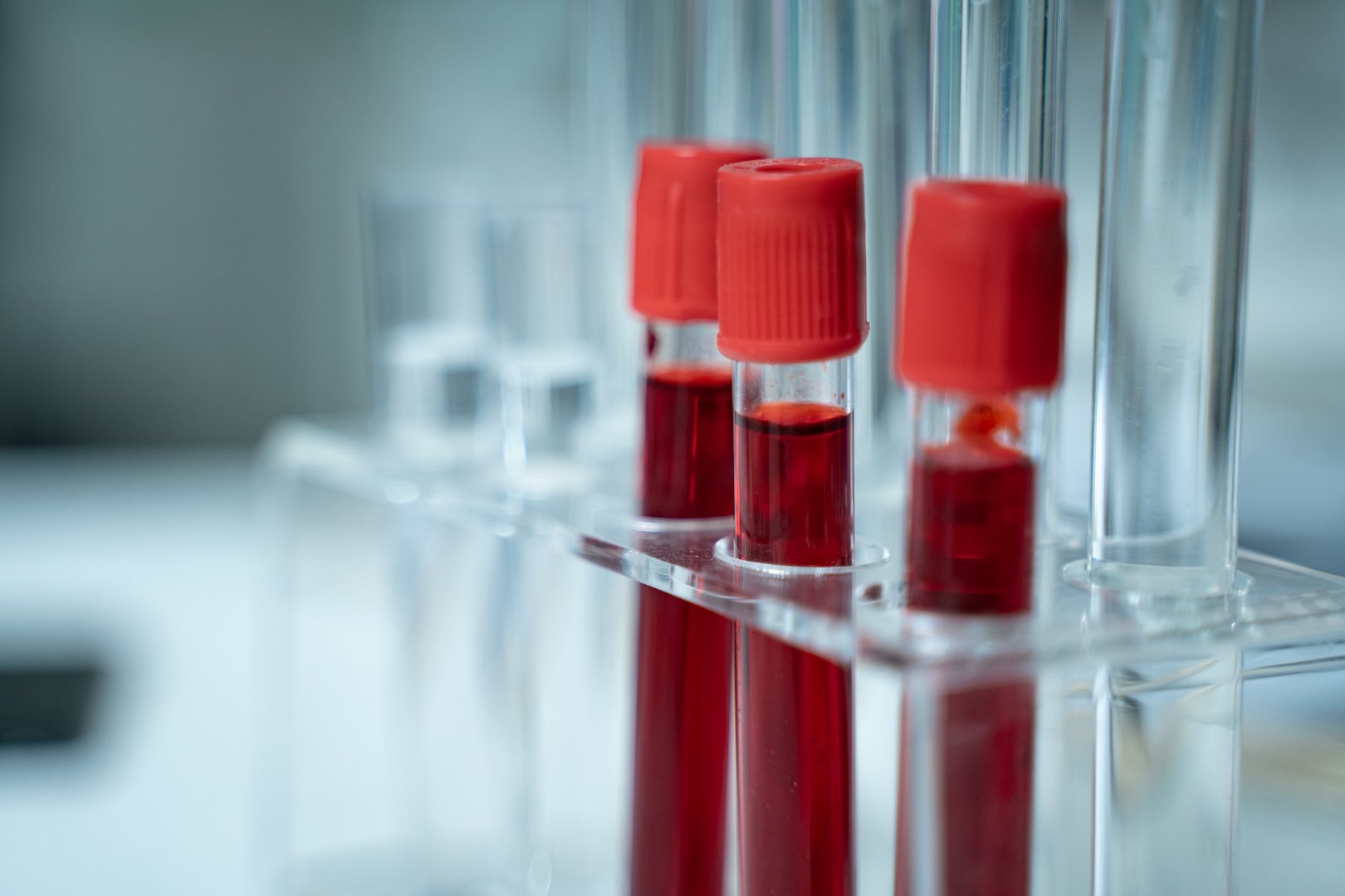 Laboratory research with blood sample in tube being dripped for medical test using liquid medicine under analysis to study results and improve scientific understanding