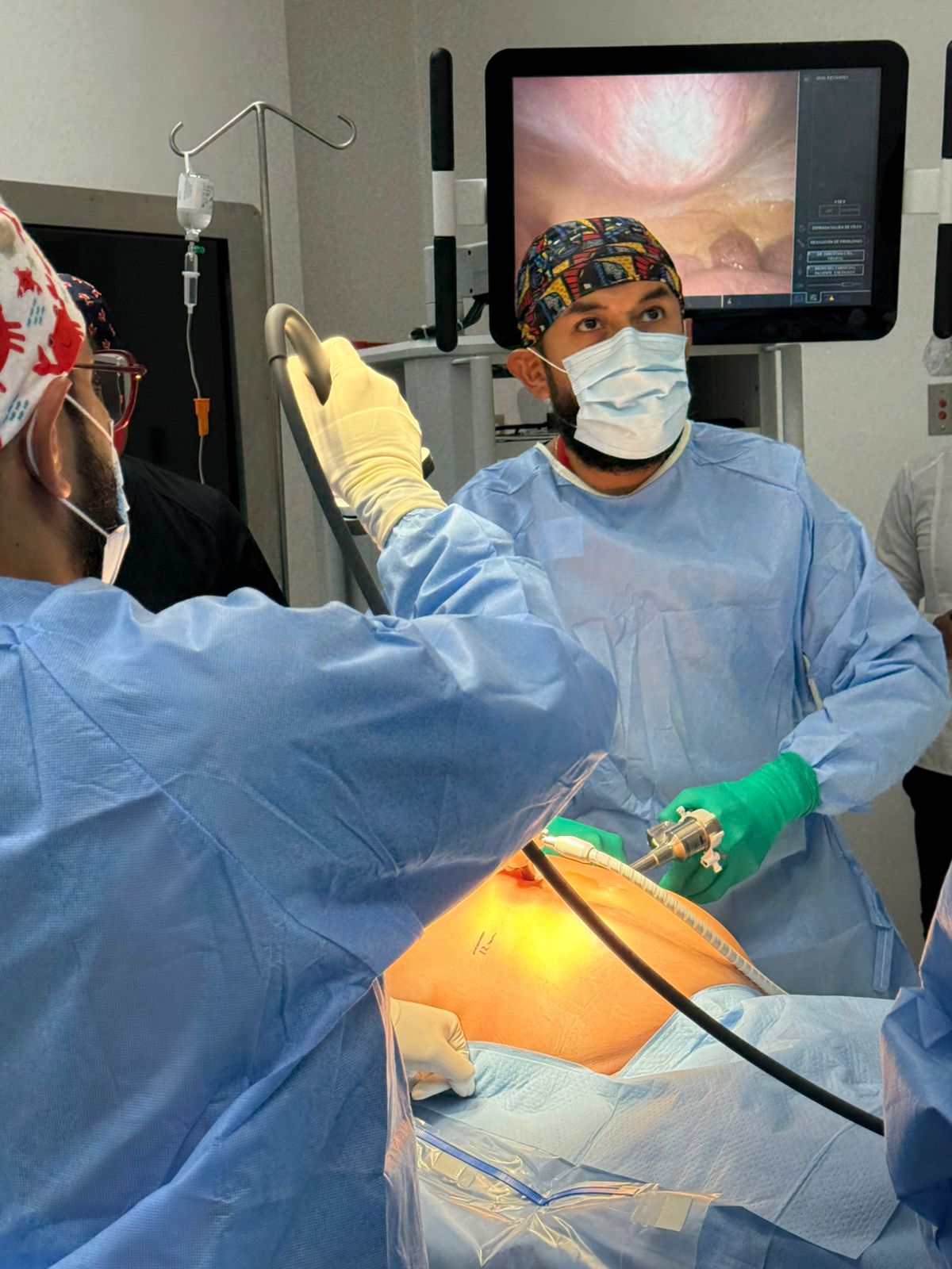 Cirujanos profesionales en la sala de operaciones. Instrumento para cirugía laparoscópica. Un cirujano realiza cirugía gástrica laparoscópica en la sala de operaciones