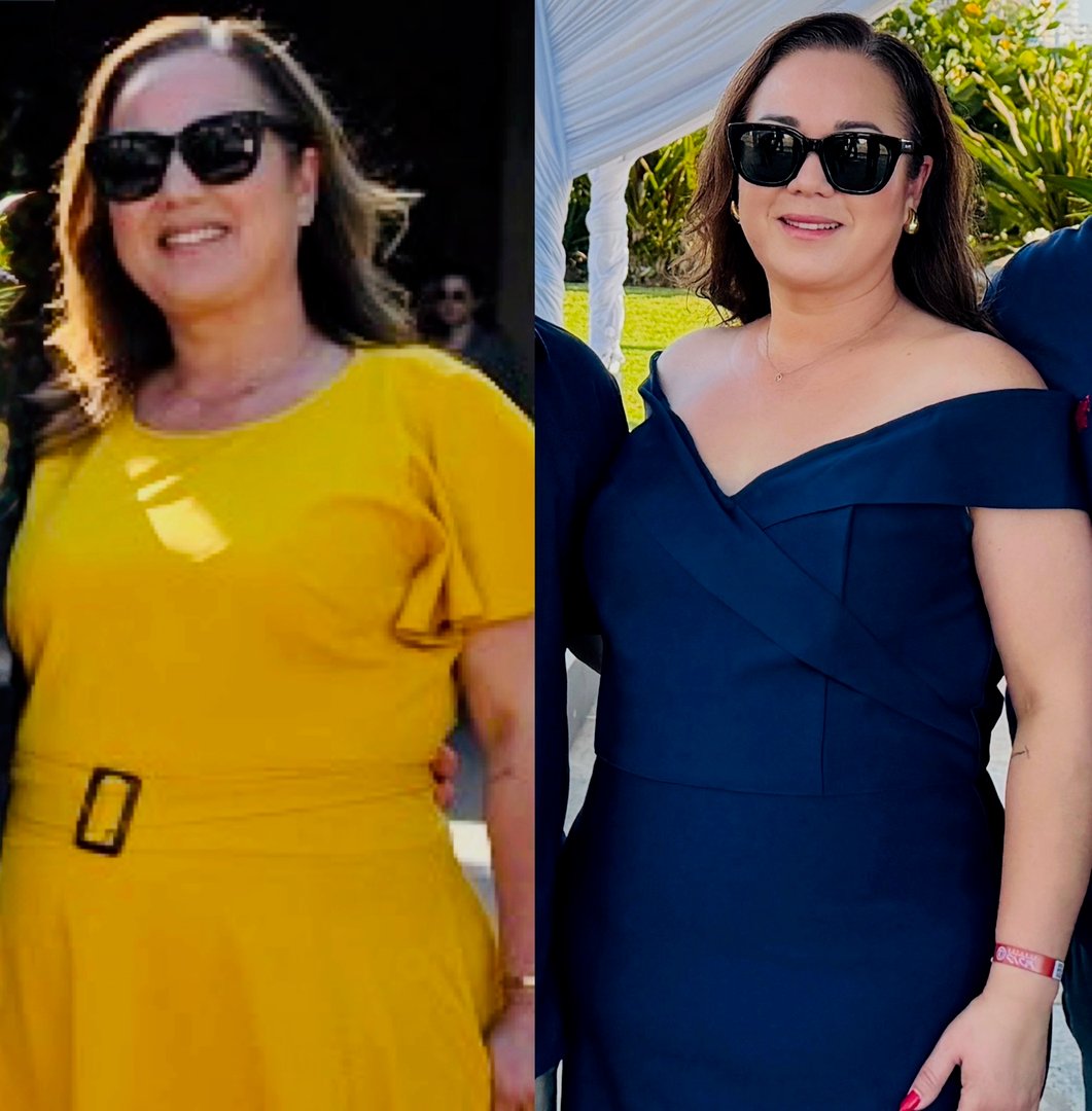 Before and after transformation