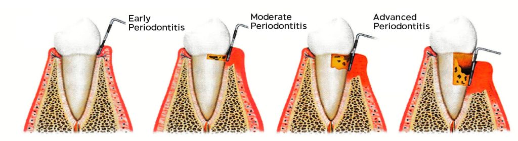 Diagram showing gums and supporting structures of teeth