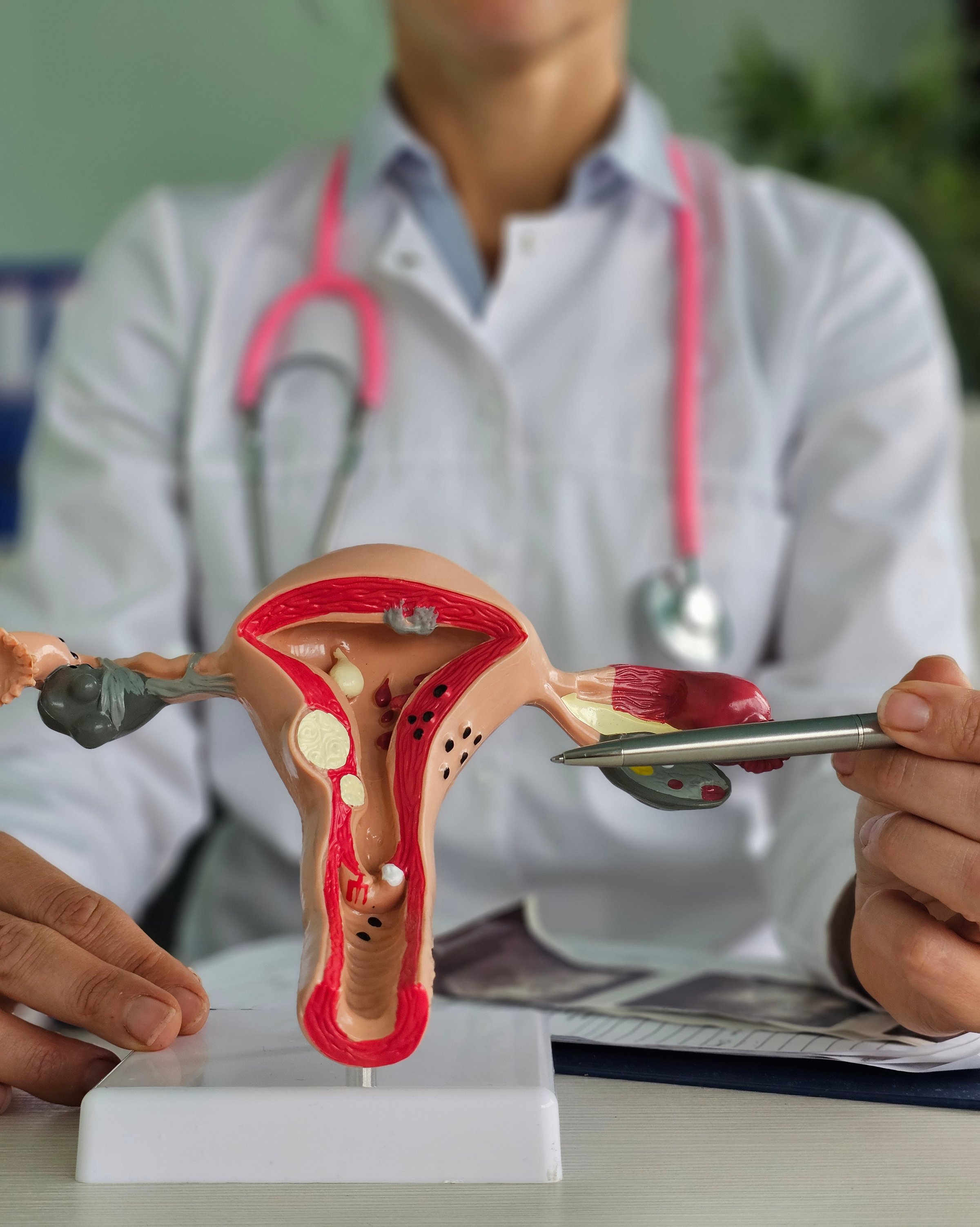 Woman gynecologist holding anatomical model of uterus and ovaries. Healthy female reproductive system, medicine, conception, education