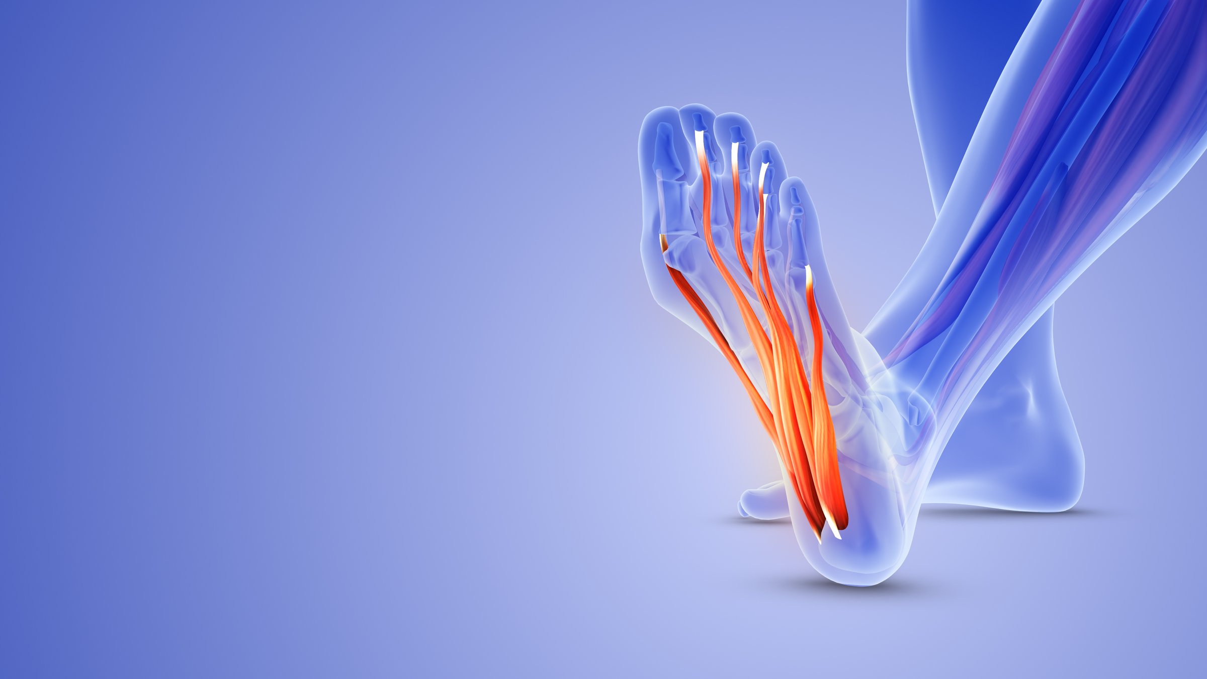 The plantar fascia is a band of tissue, called fascia, that connects your heel bone to the base of your toes. It supports the arch of the foot and absorbs shock when walking. Tension and stress on the fascia can cause small tears.