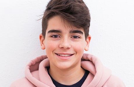 Teen orthodontic treatment options
