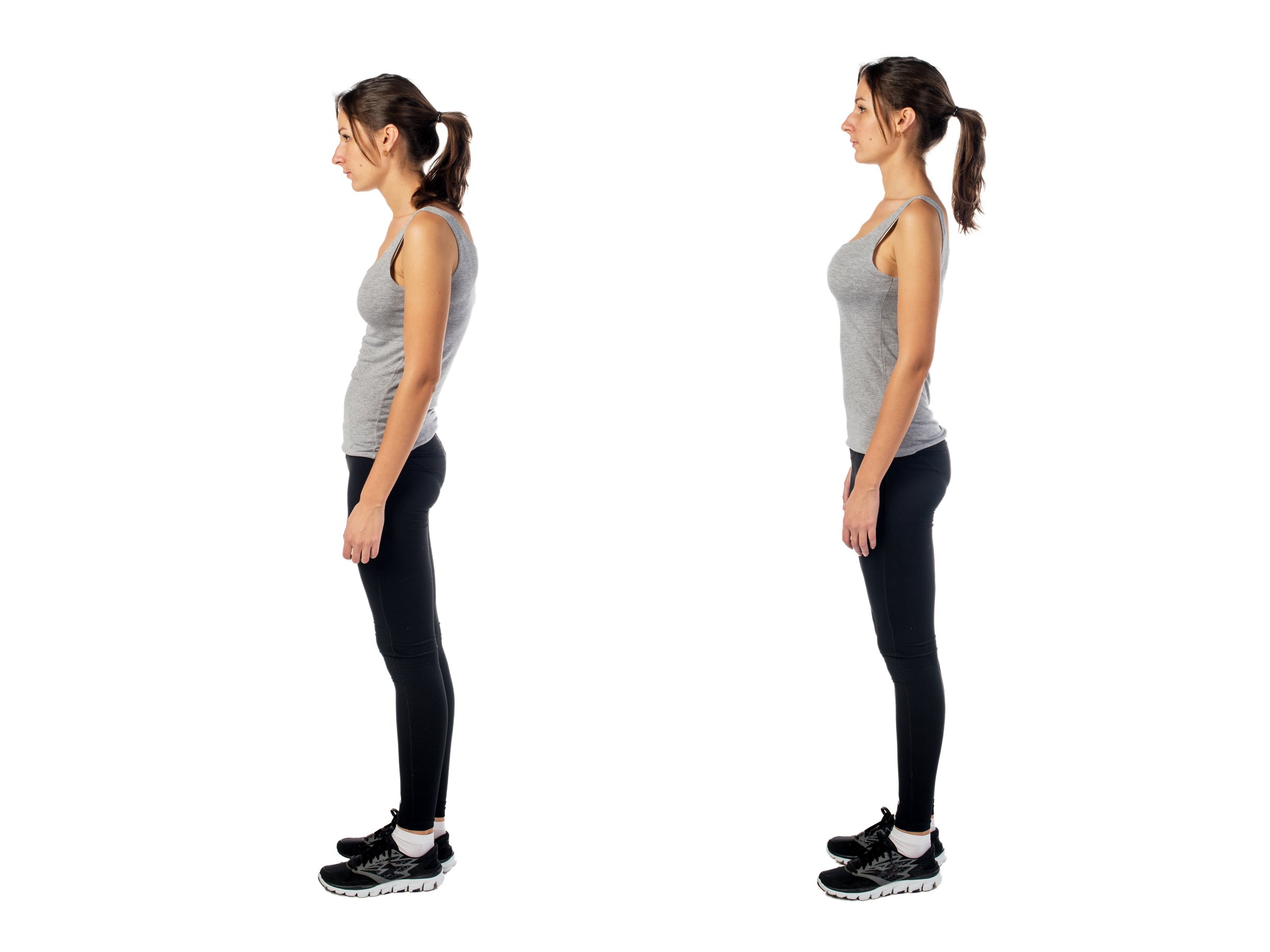 Woman with impaired posture position defect scoliosis and ideal bearing.