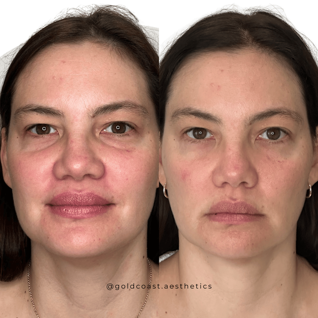 Expert facial aesthetic transformation