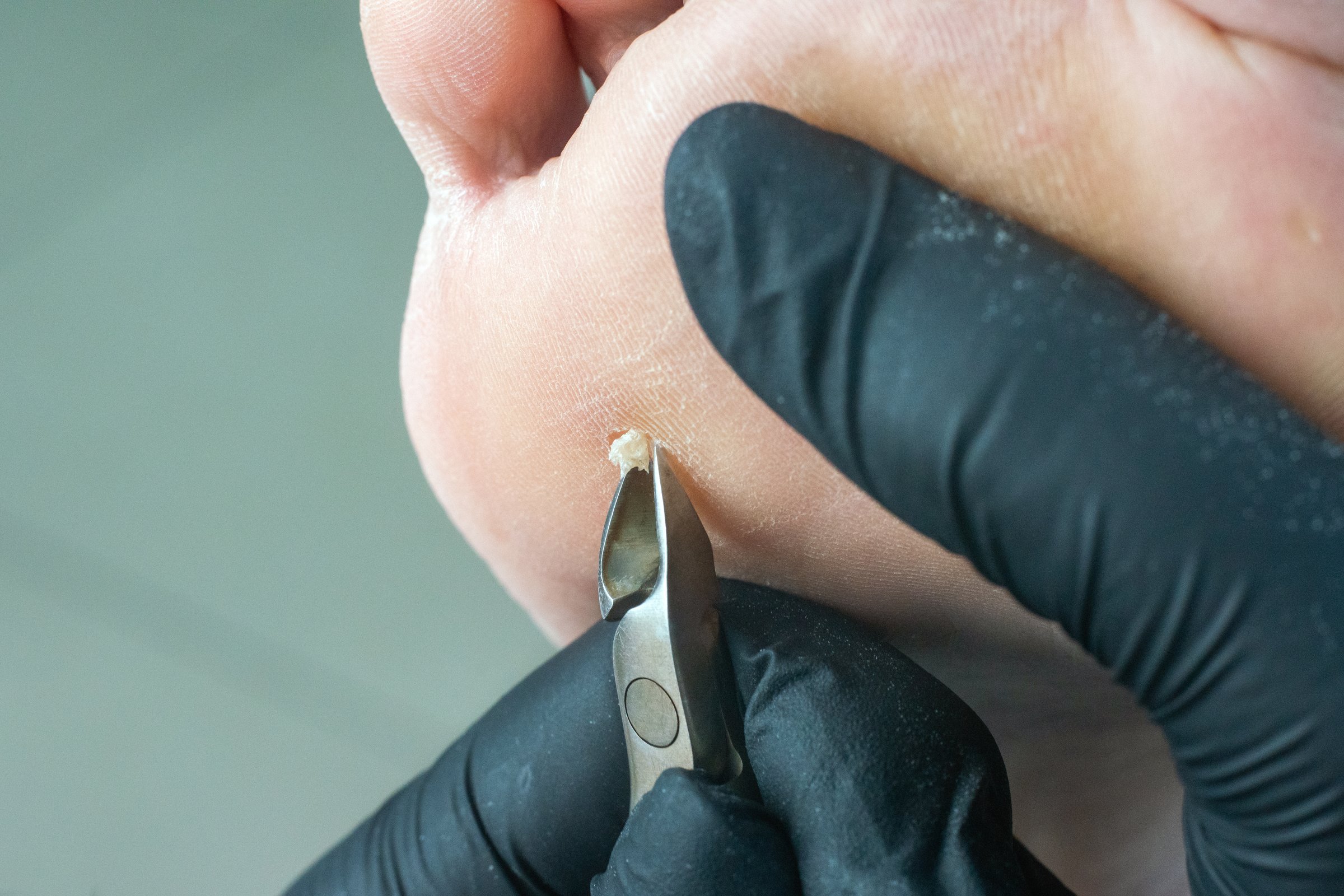 Mobile foot care professional performing diabetic foot health home visit in East London