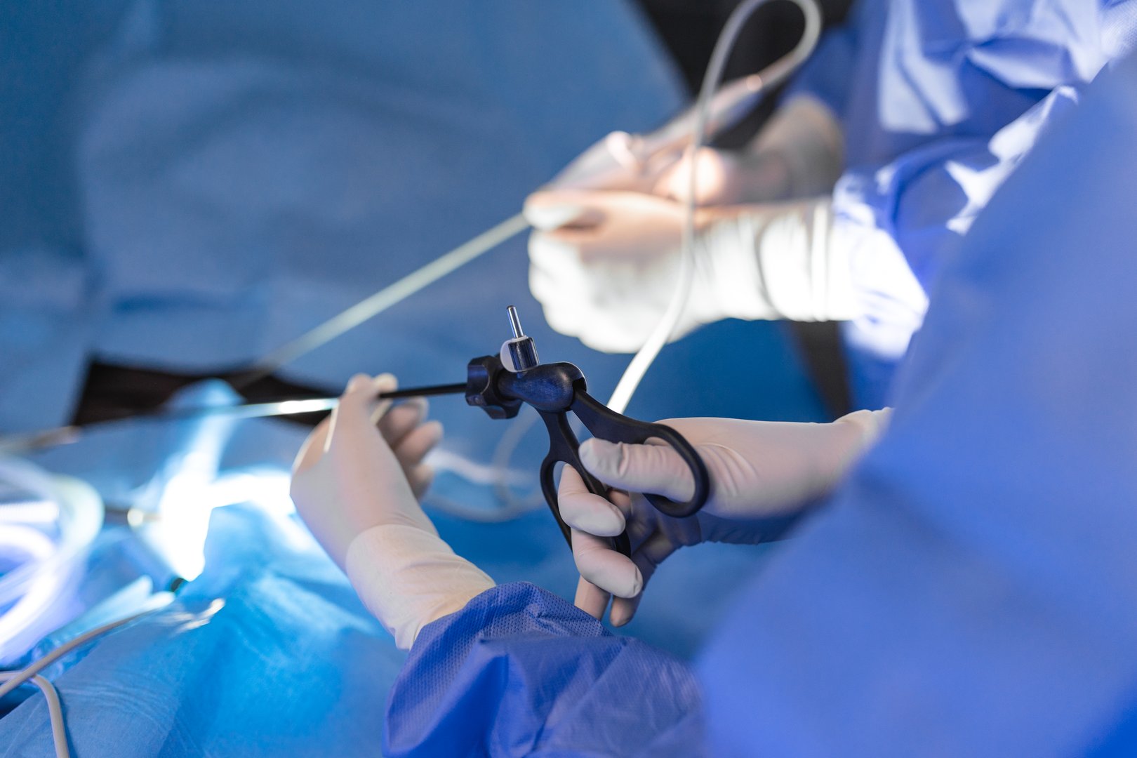 The surgeon's holing the instrument in abdomen of patient. The surgeon's doing laparoscopic surgery in the operating room. Minimally invasive surgery.