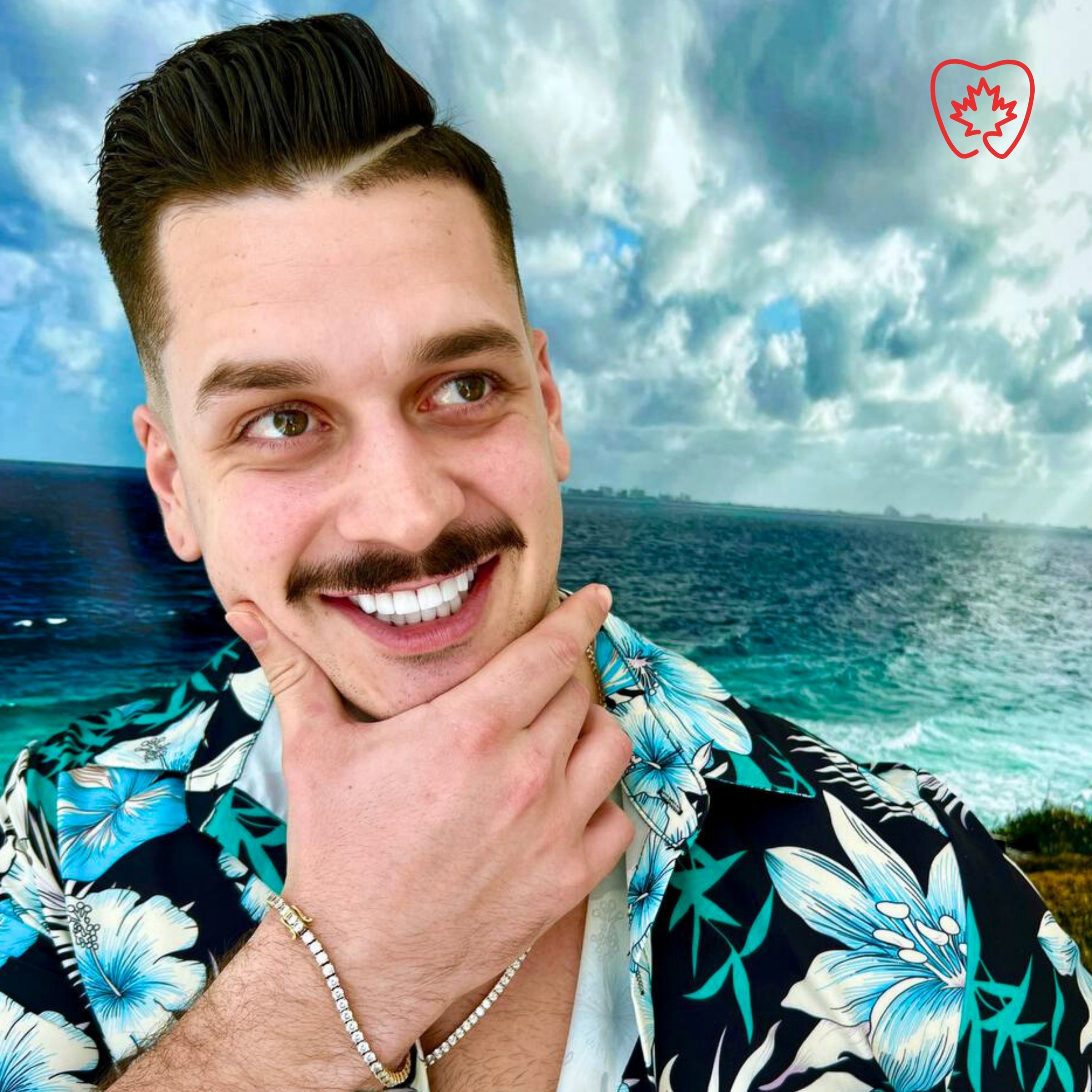 Resultado de blanqueamiento dental