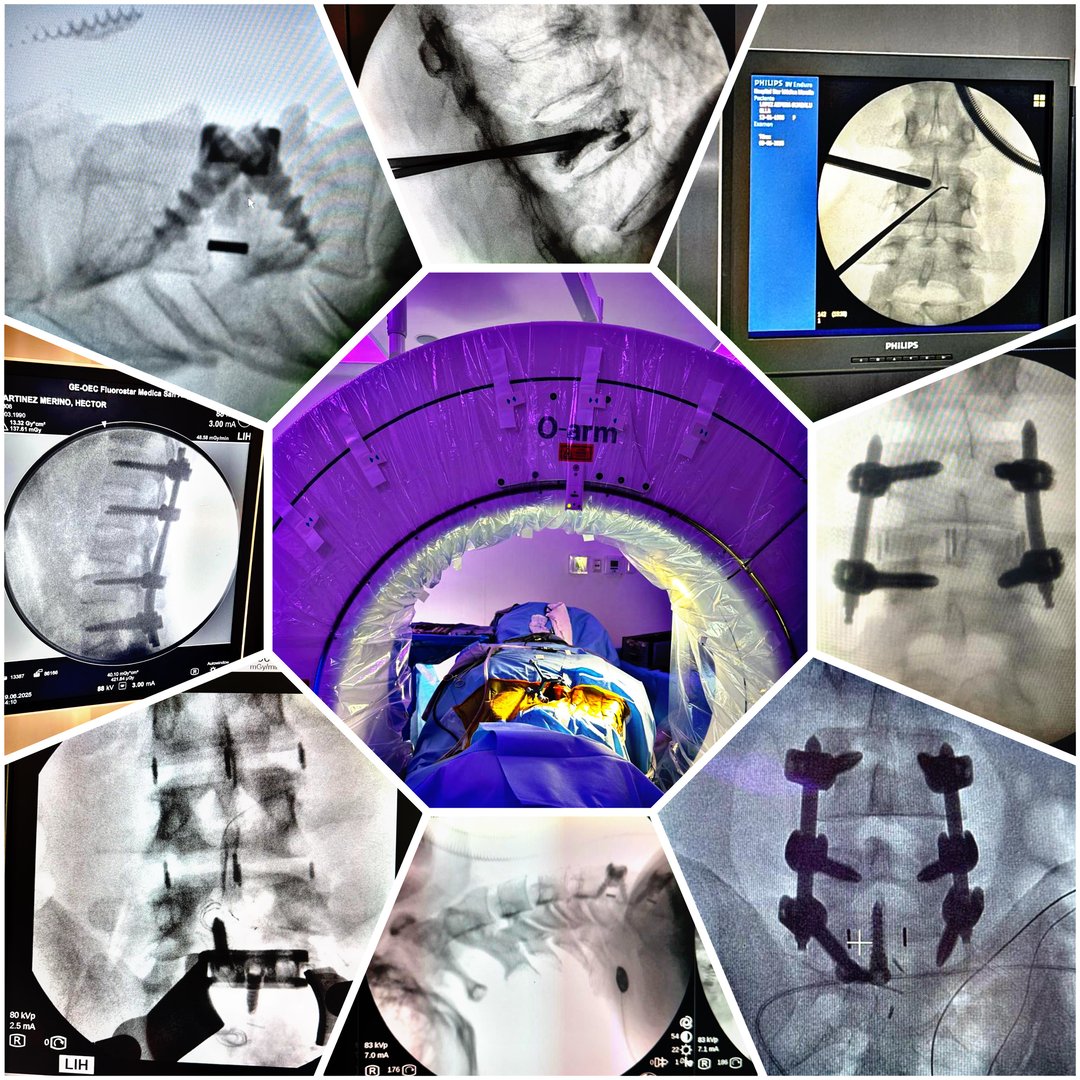 Dr. Jorge Alberto Miranda Barrera - Cirugía de Columna