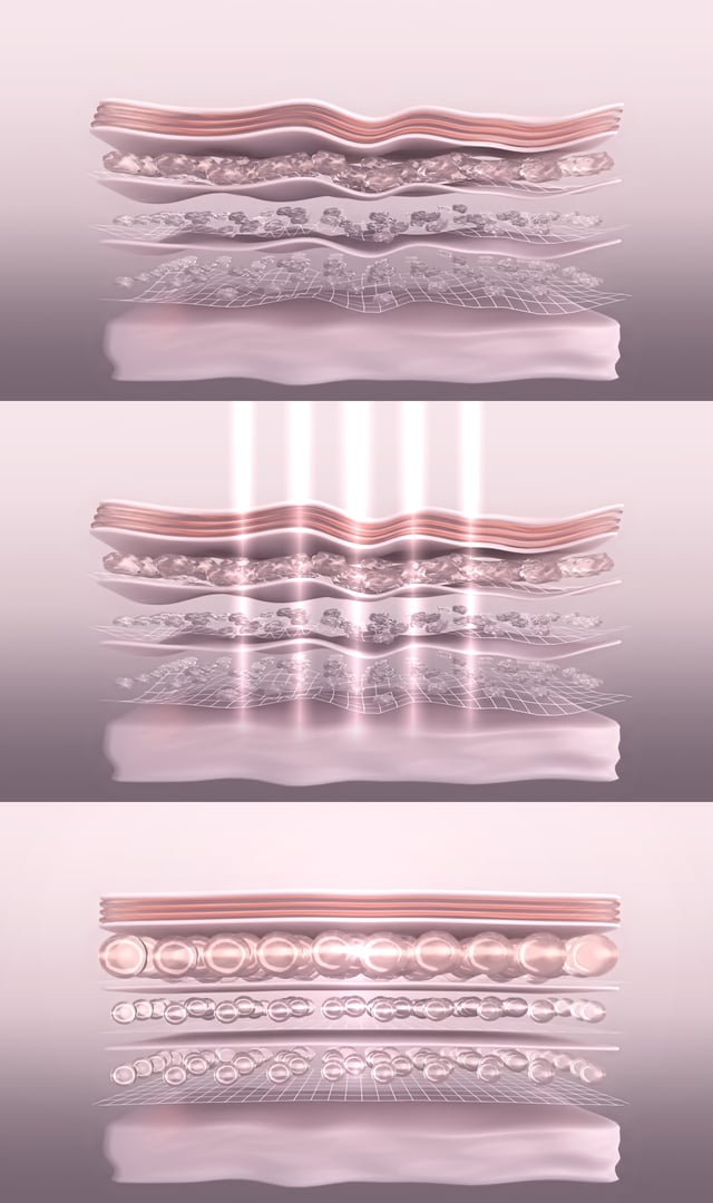 Stylized wrinkled and tightened skin layer 3D render