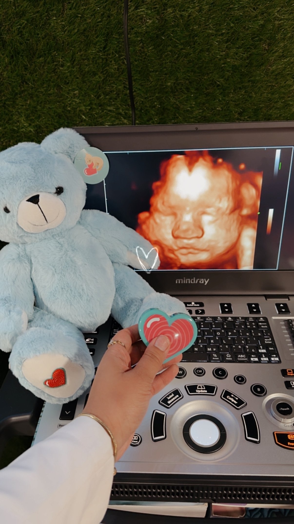 Professional ultrasound imaging