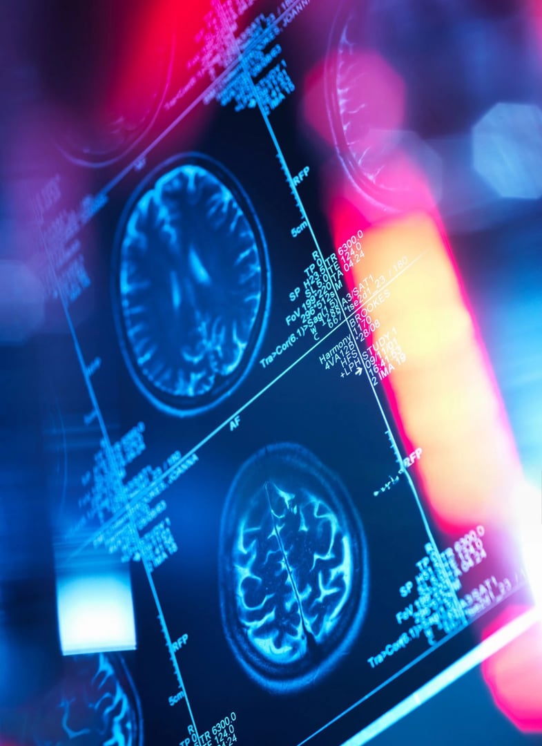 Brain scan medical imaging