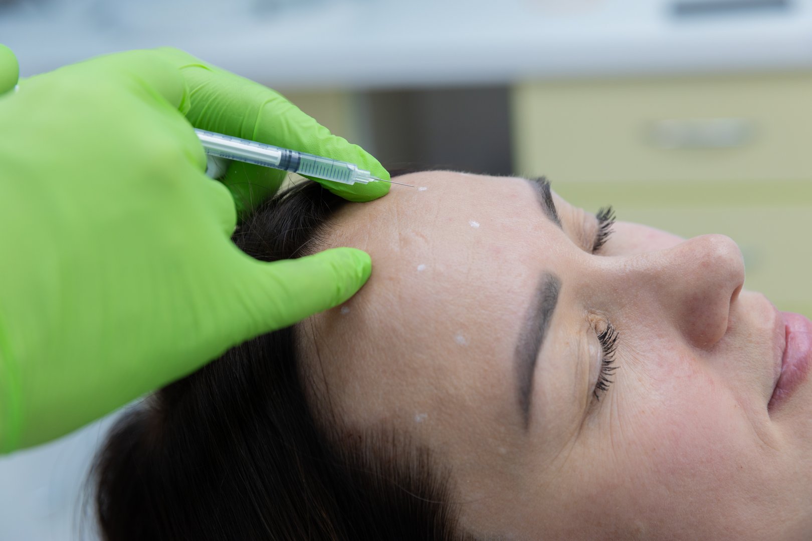In this detailed image, a healthcare professional in green gloves carefully injects a syringe into a woman's forehead, highlighting a common cosmetic treatment procedure for aesthetics.