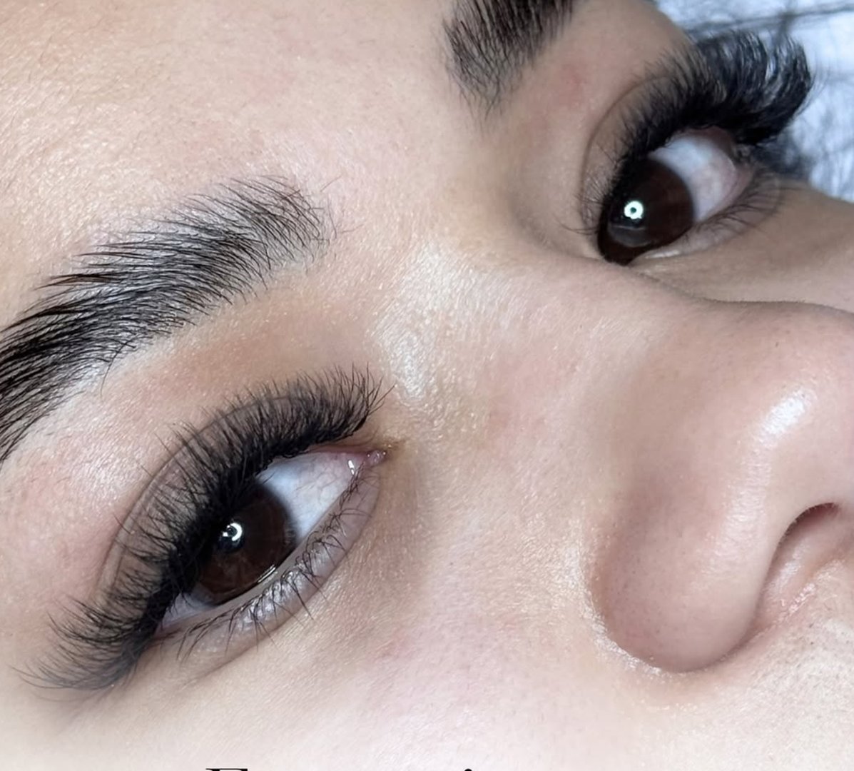 Resultados de tratamiento facial - Antes y Después