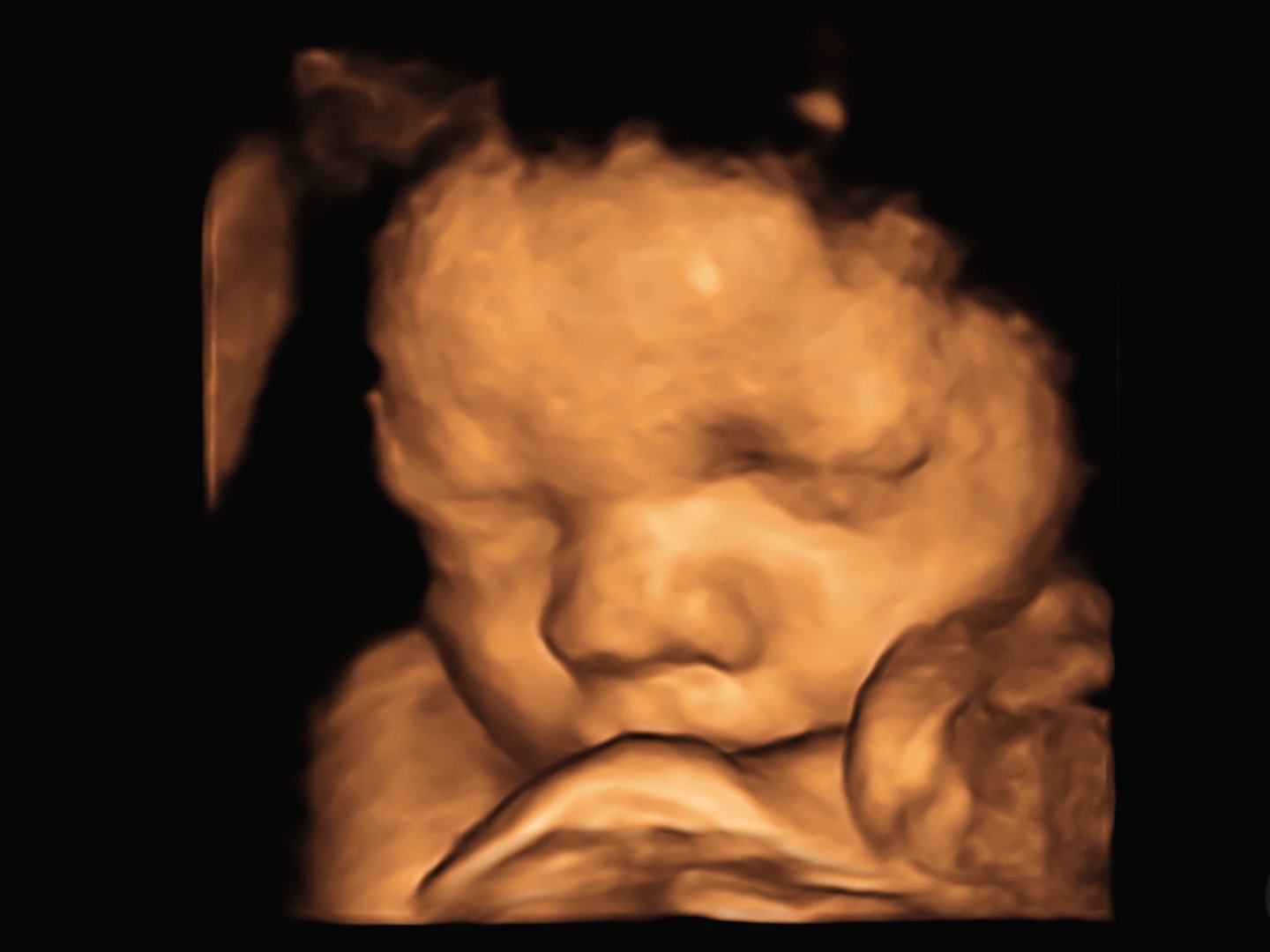 image Ultrasound 3D 4D of baby in mother's womb.