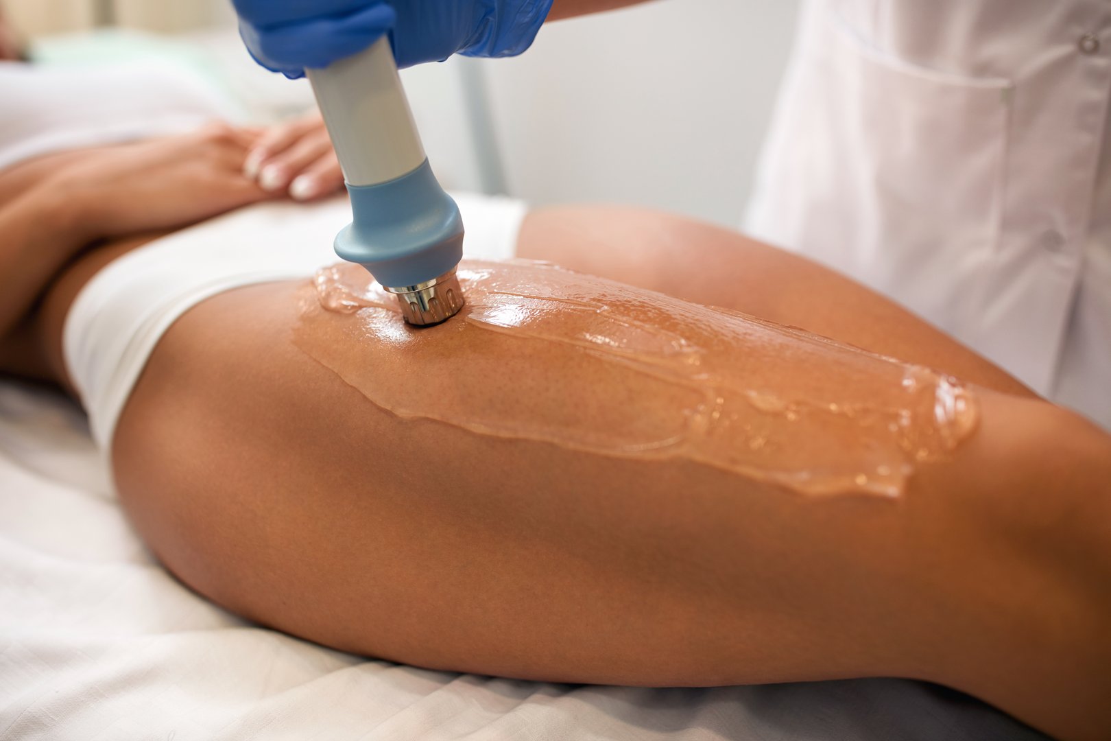 anti-cellulite treatment Shockwave acoustic wave of the thigh