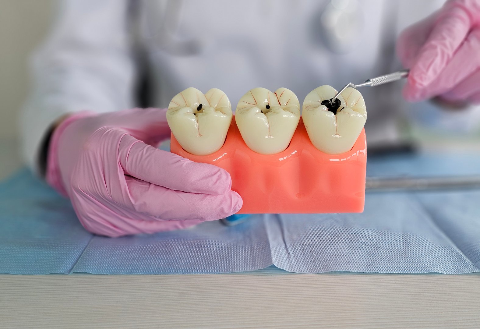 The doctor talks about dental caries and plaque, the process of demineralization, solutions to problems such as cracks, missing or broken teeth