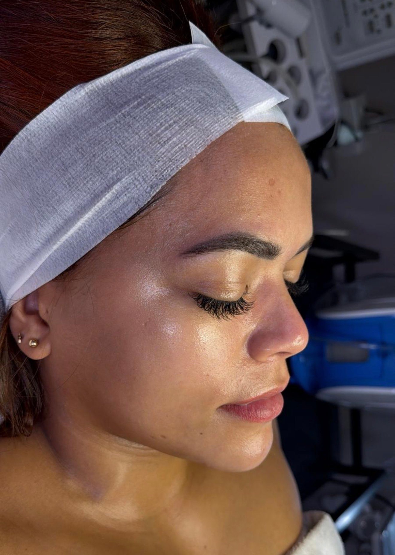 Resultado facial hidratante