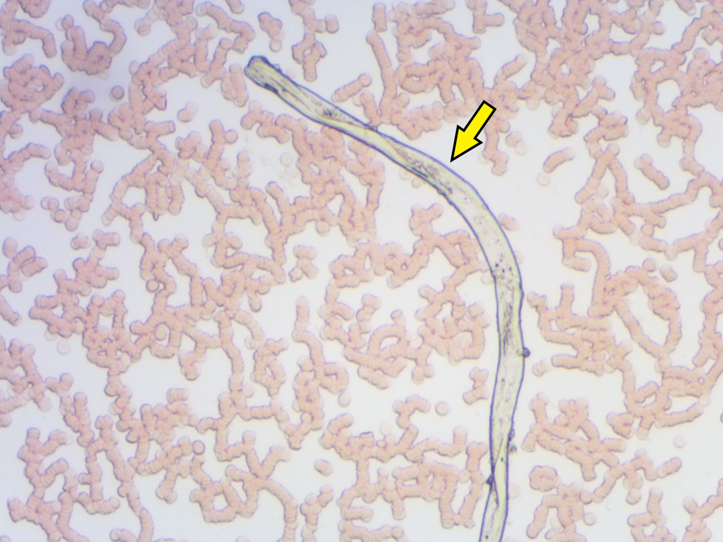 Live Blood Analysis microscopy