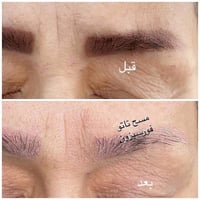 مسح تاتو • تصحيح حواجب • الكوت الهورة
