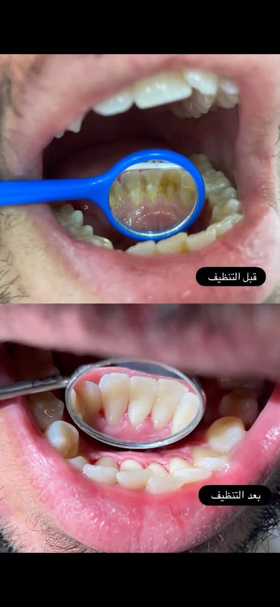 كلية طب الأسنان • خدمات مجانية • تنظيف أسنان
