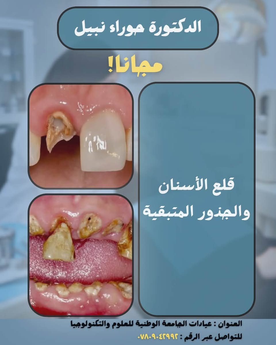 الدكتورة حوراء نبيل 

📌علاج الأسنان مجاناً بإشراف أطباء أسنان إختصاص 

الحالات والخدمات المتوفرة: 
• حشوات ضوئية
• قلع الأسنان والجذور المتبقية
• تعويض الأسنان المفقودة بطقم جزئي متحرك
• تنظيف الأسنان

📍العنوان : الناصرية - التضحية - عيادات الجامعة الوطنية للعلوم والتكنولوجيا

📞 للتواصل عبر الخاص او الرقم : ***********

نص مكتوب في الصور:
- الدكتورة حوراء نبيل مجاناً! BEFORE AFTER حشوات ضوئية العنوان : عيادات الجامعة الوطنية للعلوم والتكنولوجيا للتواصل عبر الرقم : ***********
- الدكتورة حوراء نبيل مجاناً! قلع الأسنان والجذور المتبقية العنوان : عيادات الجامعة الوطنية للعلوم والتكنولوجيا للتواصل عبر الرقم : ***********
- الدكتورة حوراء نبيل مجاناً! تعويض الأسنان المفقودة بطقم جزئي متحرك العنوان : عيادات الجامعة الوطنية للعلوم والتكنولوجيا للتواصل عبر الرقم : ***********
- الدكتورة حوراء نبيل مجانا! تنظيف الأسنان العنوان : عيادات الجامعة الوطنية للعلوم والتكنولوجيا للتواصل عبر الرقم : ***********