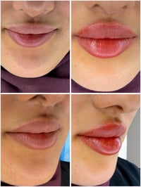 جلدية وتجميل • افتتاح قريب • النعمانية