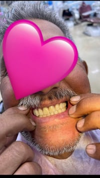 طقم اسنان متحرك • مجانا • الكرادة