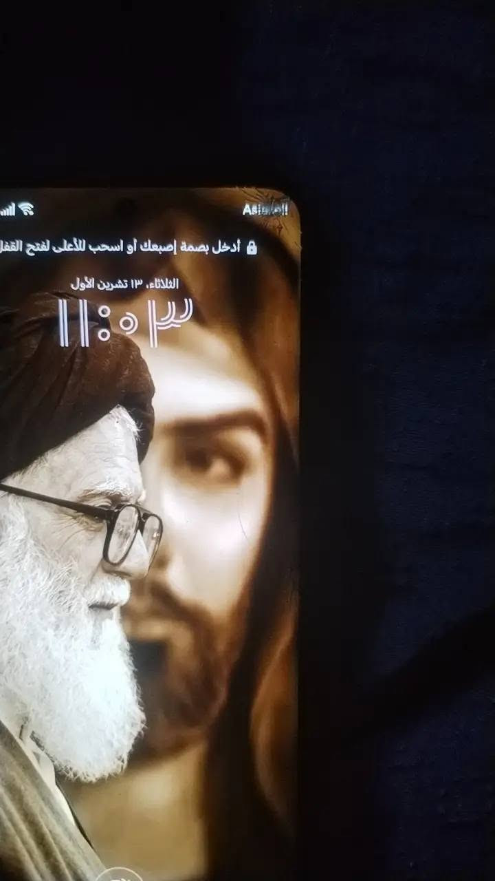 هونر X9b • ٢٥٦ • كدامك