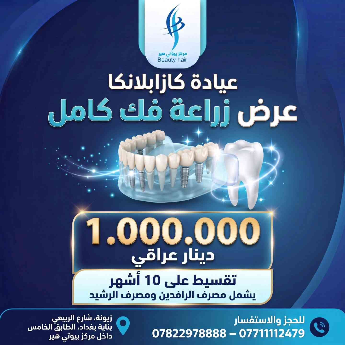 ابتسامة هوليوود • زراعة أسنان • زيونة