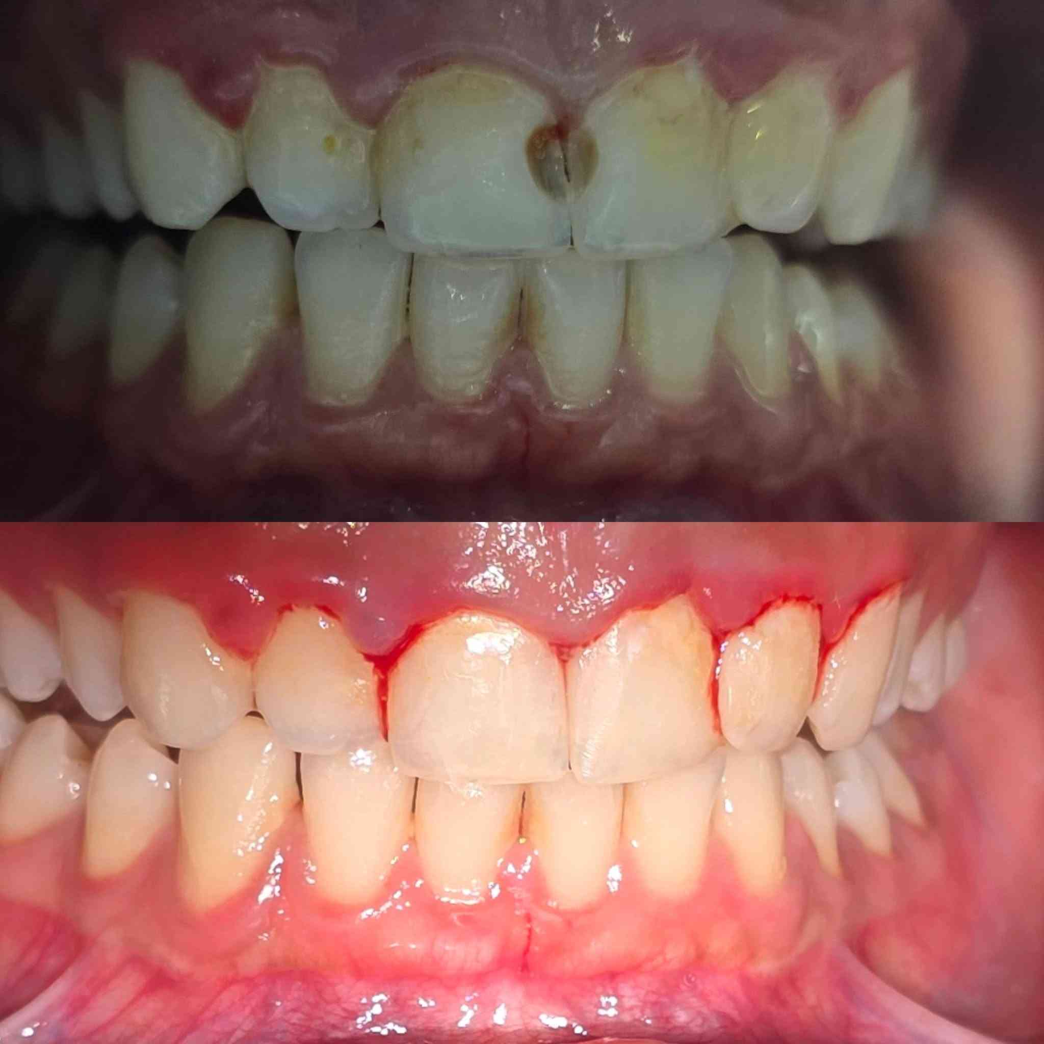 متواجدين يوميا في عيادة اصلان من الساعه الرابعه عصراً
ولقسمين الاسنان والتجميل 
للحجز ***********
