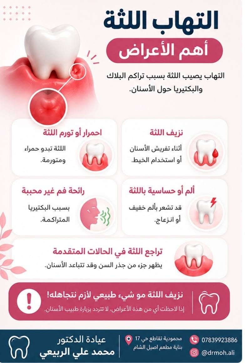 الألم مو دائمًا بسبب أسنانك… أحيانًا يكون سببه التهاب اللثة! 🦷

حسّيت بأعراض التهاب اللثة؟ لا تهملها… احجز موعدك اليوم 

علماً الفحص والمعاينة مجاني 💯

عيادة الدكتور محمد علي  الربيعي 

#محمودية تقاطع حي 17 بناية مطعم اصيل الشام 

للحجز مراسلة الصفحة
 
واتساب العيادة ***********
@drmoh.ali
