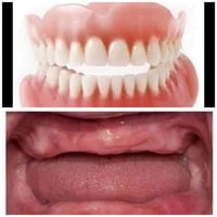 طقم كامل • بالمجان • حالتين فقط