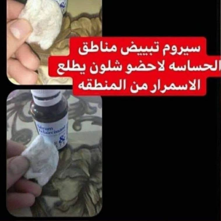 سيروم الفرنسي 
اذا جنتي تعانين من تصبغات قوي تحت الابط 
وبالمنطقة الحساسة 
جربتي هواية شغلات هل السيروم يقشر بلطف يزيل السواد ينضف الج المنطقة بشكل نهائي 
المنطقة بشكل 
بياض طبيعي 🌸🌸

للحجز ***********

