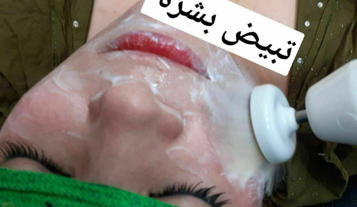 تنظيف بشرة • تبيض وترطيب • حي الحسين