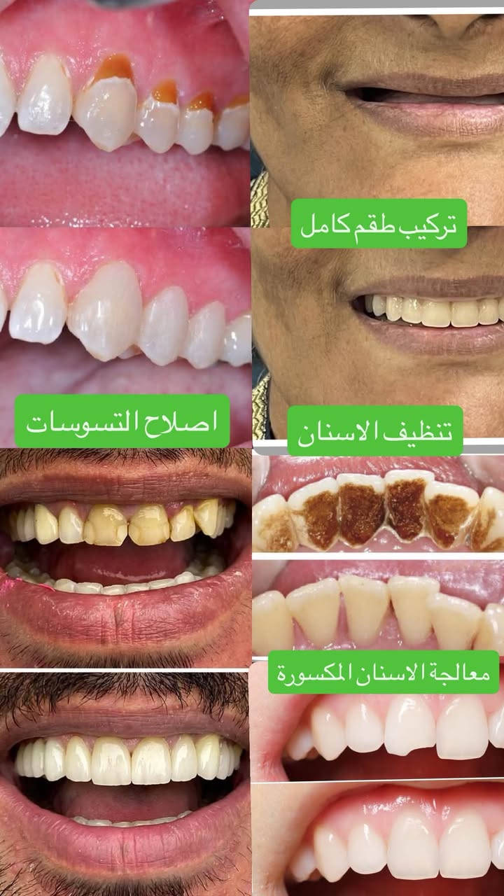 مجاني • ميسان عيادات الجامعة • علاج اسنان