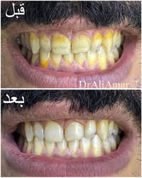 تنظيف مجاني • طوارئ ٢٤ ساعة • الحسينية الراشدية