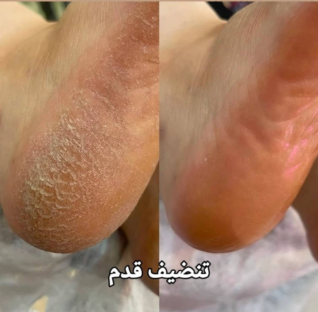 جل اكستيشن • سترونك • تنظيف قدم