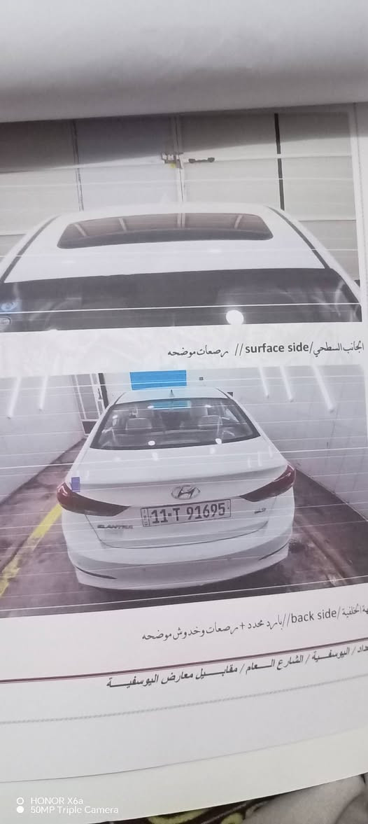 اسلام عليكم النترا 17خليجي
سونار موجود بالمنشور
سياره خير من الله
بأسمي سياره فول مواصفات ما عدا البصمه ***********
***********

نص مكتوب في الصور:
- HONOR X6a
- 50MP Triple Camera
- الجانب الايمن/ right side // صبغ ومعجون وبارد محدد + مرصعات وخدوش موضحه
- الجانب الايسر/ left sid // صبغ ومعجون وبارد محدد + مرصعات وخدوش موضحه
- بغداد / اليوسفية / الشارع العام / مقابل معارض اليوسفية
- الجانب السطحي/ surface side // مرصعات موضحه
- ة الخلفية/ back side// بارد محدد + مرصعات وخدوش موضحه
- داد / اليوسفية / الشارع العام / مقابل معارض اليوسفية