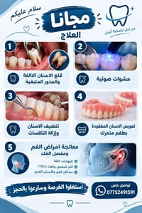 علاج سنان مجاني • خلع سنان • حشوات ضوئية