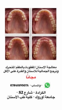 طقم متحرك • مجاني • الكرادة