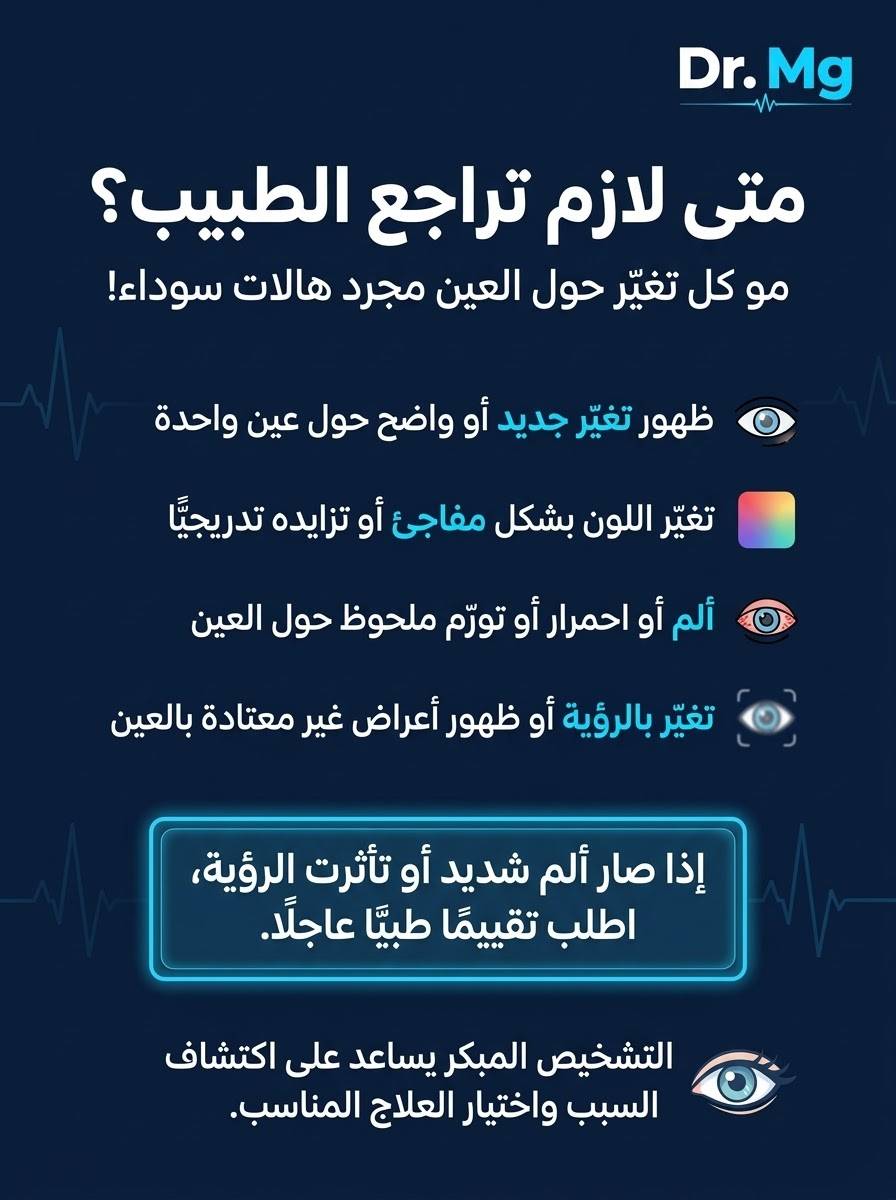 هالات تحت العين • عناية بالبشرة • استشارة خاصة