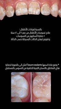 المنصور • جامعة التراث • العلاج مجاني