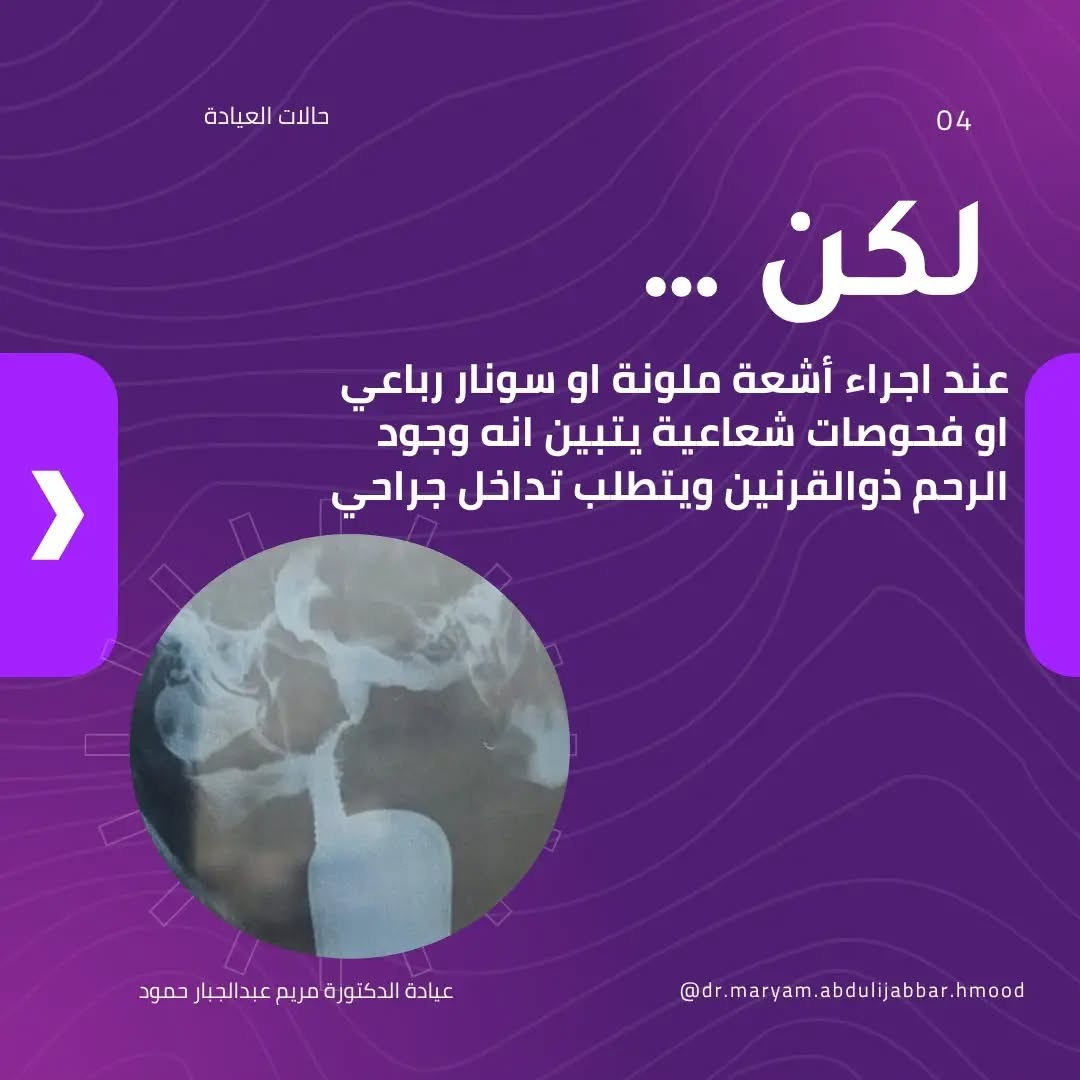 الرحم ذو القرنين • إسقاطات متكررة • عيادة د.مريم