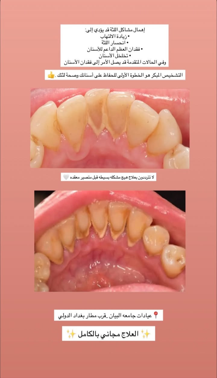 علاج أسنان مجاني • جامعة البيان • قرب مطار بغداد