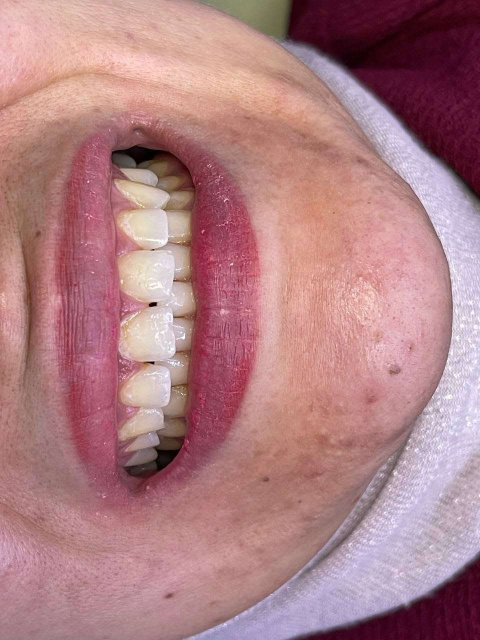 حشوات تجميلية • آية الزيدي • الطوبجي