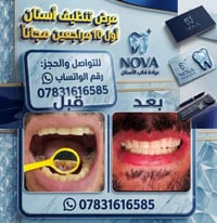تنظيف اسنان • تبييض اسنان • استشارة بالبيت